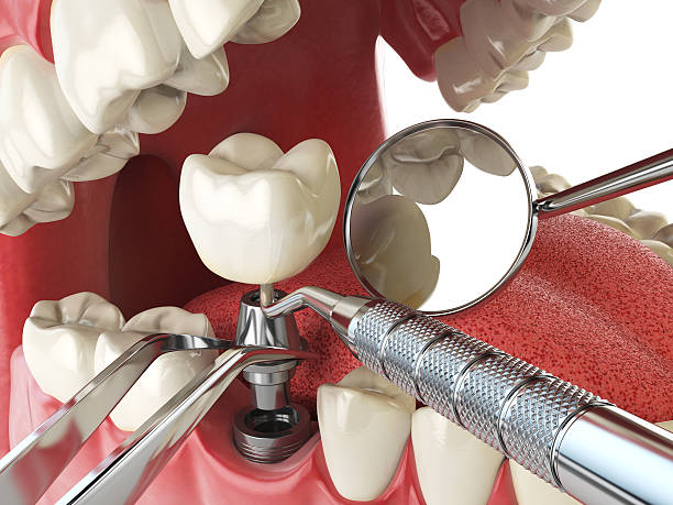 Best Same-Day Emergency Dentist in Country Clu, MO