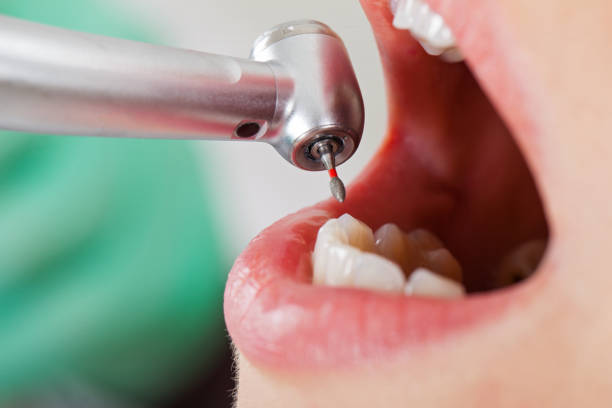 Best After-Hours Emergency Dentist in Country Clu, MO